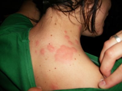 Chemtech Exterminating Corp: Bed Bug Exterminator - Forest Hills, NY
