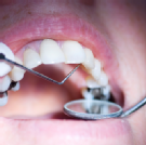 Southport Dental Indianapolis - Greenwood Southport Dental Indianapolis - Greenwood