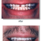 Photo - Oak Creek Dental Care - Columbus Ohio