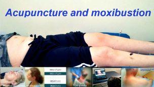 acuphysio acupuncture and physical therapy Photo