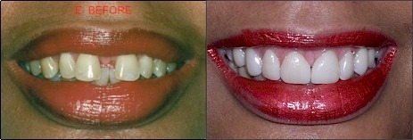 Center for Cosmetic Dentistry, Bernard Genet DDS - Clementon, NJ