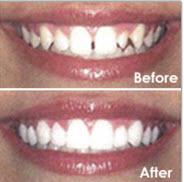 Albany Group Dental Practice PLLC Photo