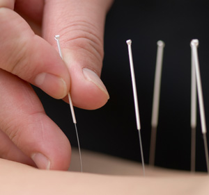 Accident, Athletic & Back Care - Saint Charles, MO
