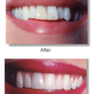 Photo - Oak Creek Dental Care - Columbus Ohio