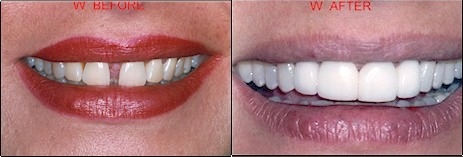 Center for Cosmetic Dentistry, Bernard Genet DDS - Clementon, NJ