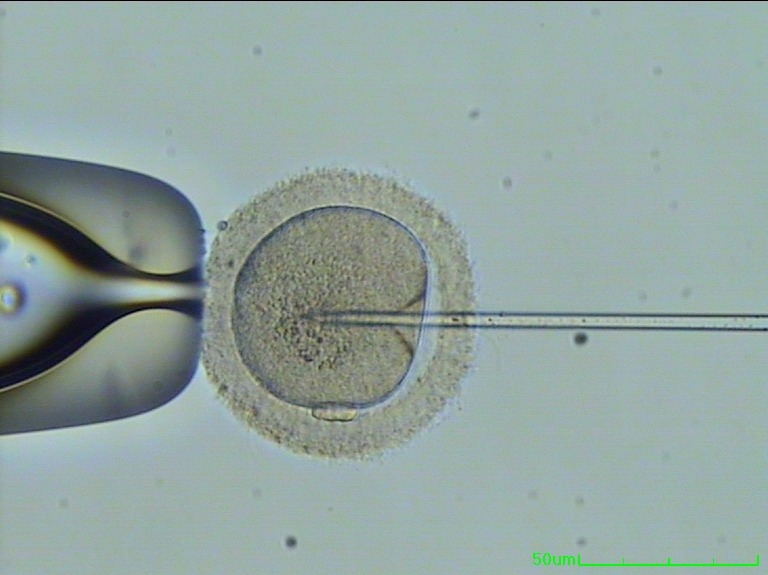 sperm in urinanalysis fergie from black eyed peas naked