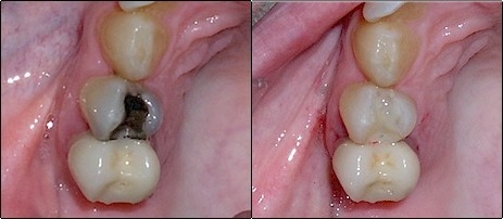 Center for Cosmetic Dentistry, Bernard Genet DDS - Clementon, NJ