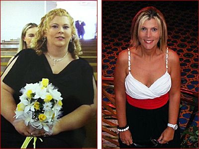 doctor weight loss albany doctor weight loss albany