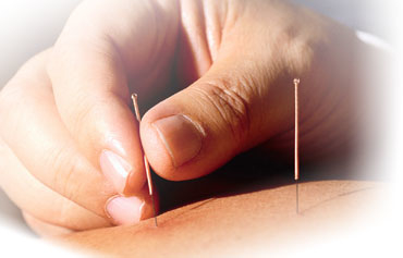 Ping Traditional Chinese Medicine Clinic - Durham, NC
