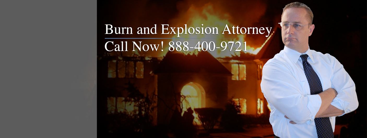 Burns and Explosions Attorneys