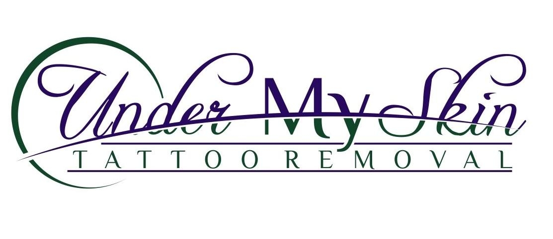 Under My Skin Tattoo Removal- Springfield-Branson-Southwest Mo.